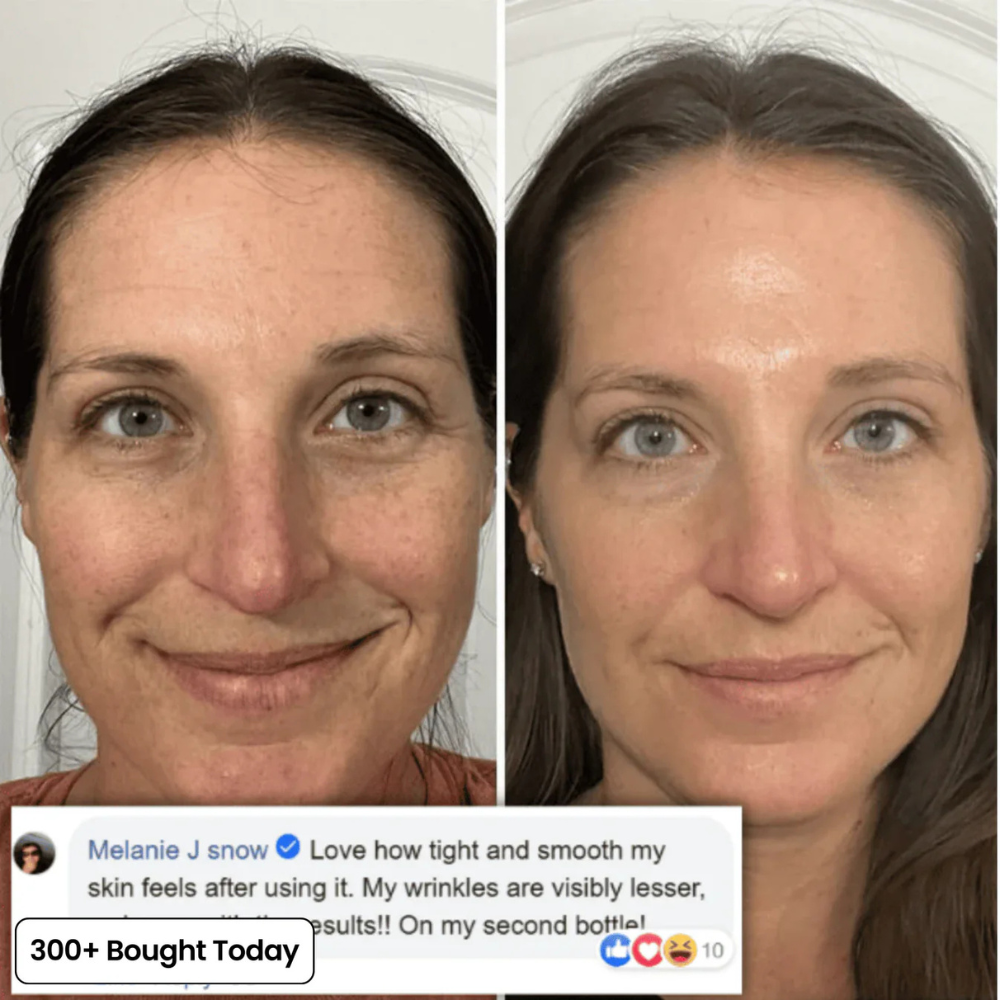 Dermly™ Insta Glow Stick