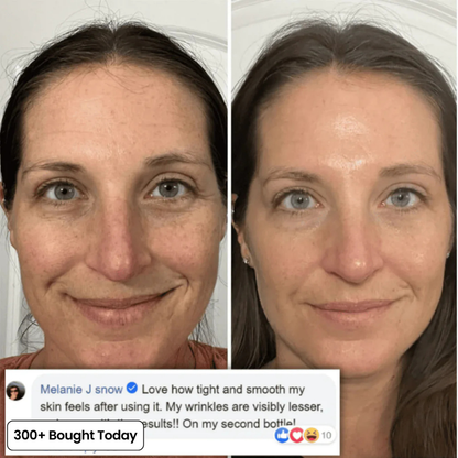 Dermly™ Insta Glow Stick