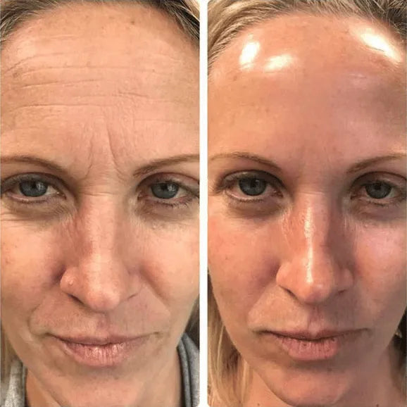 Simple Routine. Visible Results in Days.