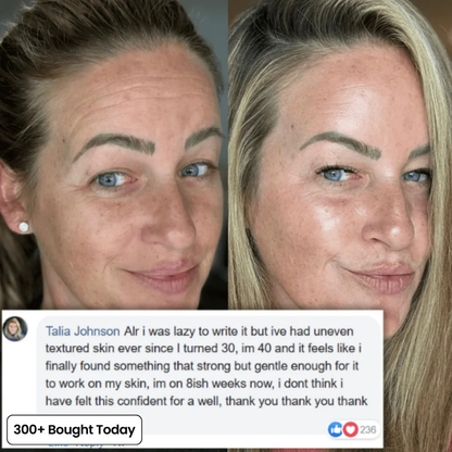 Dermly™ Insta Glow Stick