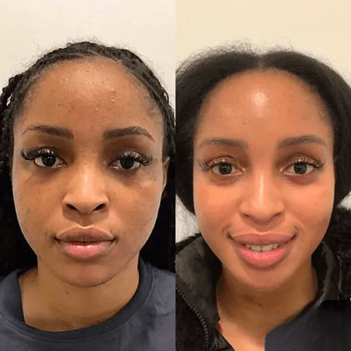 <p>See Why Women Everywhere Choose Dermly</p>