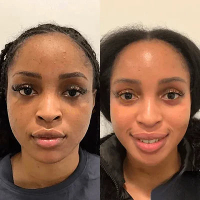 Dermly skincare