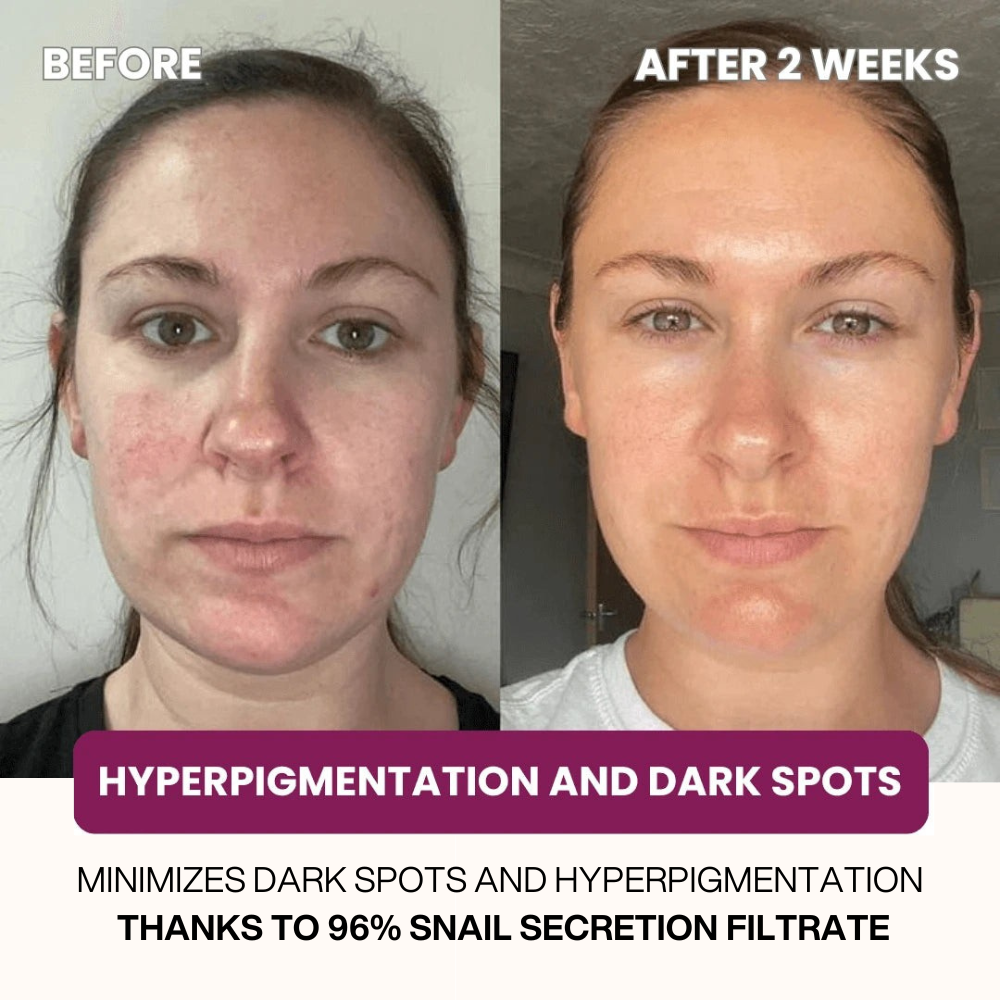 Dermly™ Advanced Snail 96 Mucin Face Mask