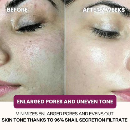 Dermly™ Advanced Snail 96 Mucin Face Mask