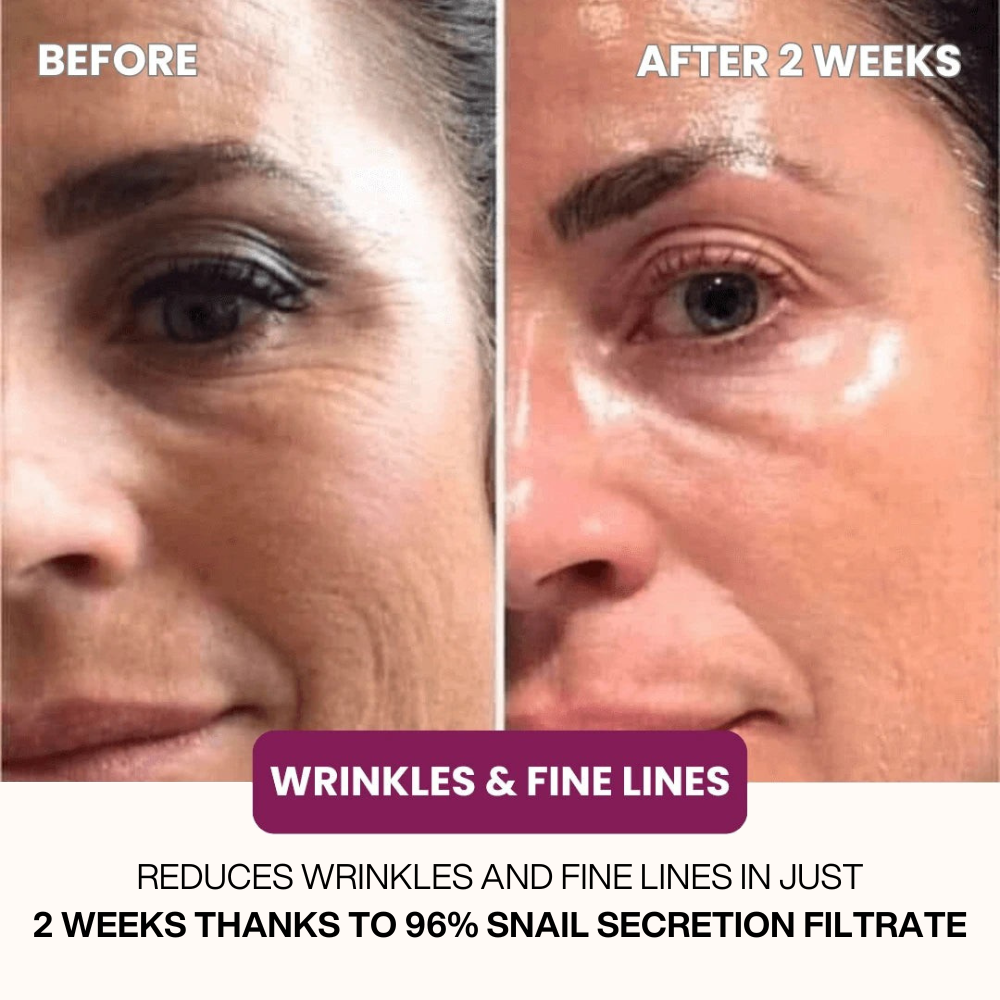 Dermly™ Advanced Snail 96 Mucin Face Mask