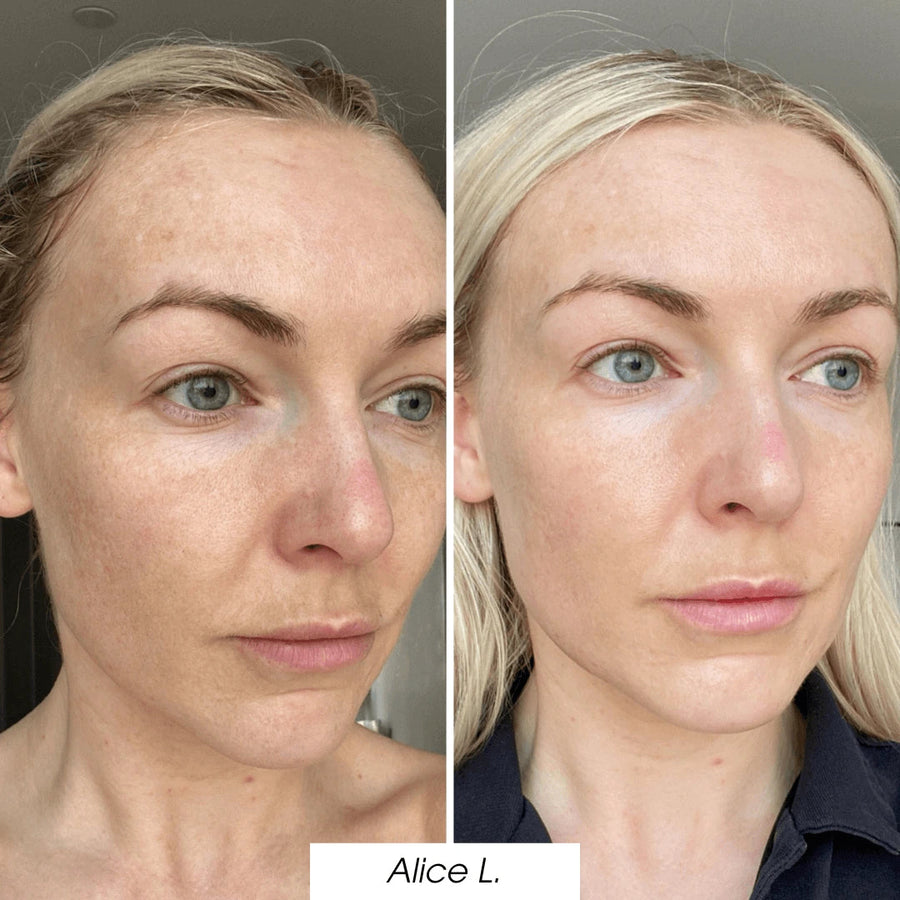 Simple Routine. Visible Results in Days.
